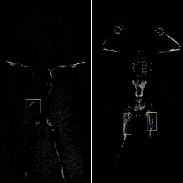 Досмотровый сканер Генезис МД-02А, мм-волновый Досмотровый сканер Генезис МД-02А, мм-волновый